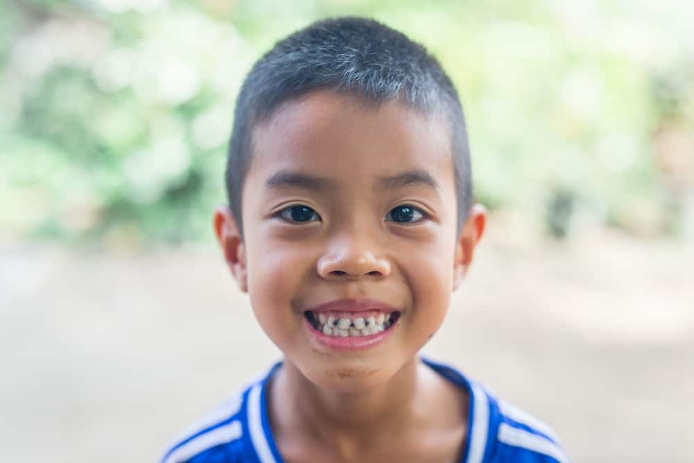 I denti neri e porosi di un bambino si trasferiranno nell'età adulta?