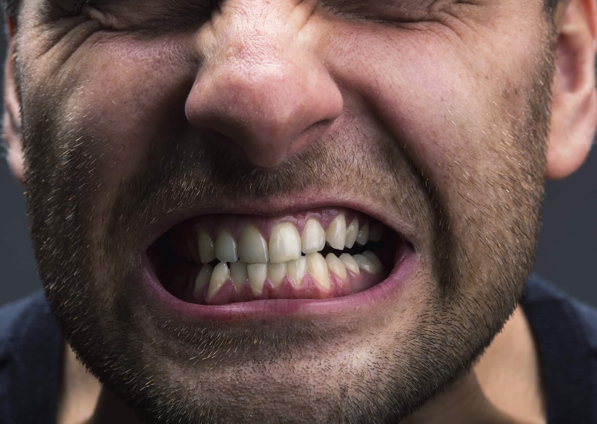 3 disturbi della bocca causati dallo stress