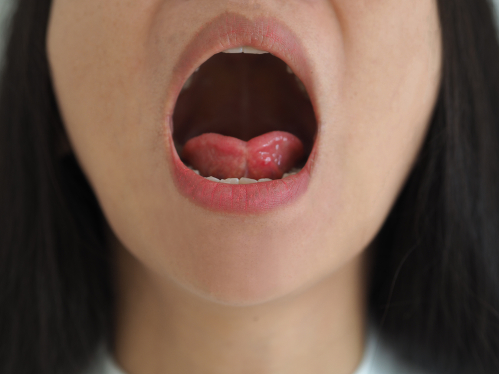 lingua ingoiata