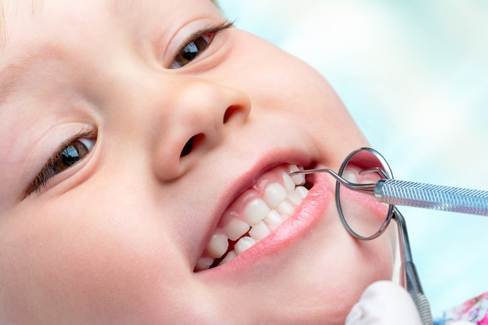 في أي عمر يمكن للأطفال البدء بتنظيف الجير عند طبيب الأسنان؟