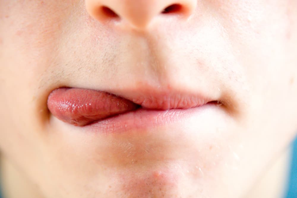 Lingua pelosa, una strana condizione che si verifica a causa della pulizia rara della bocca