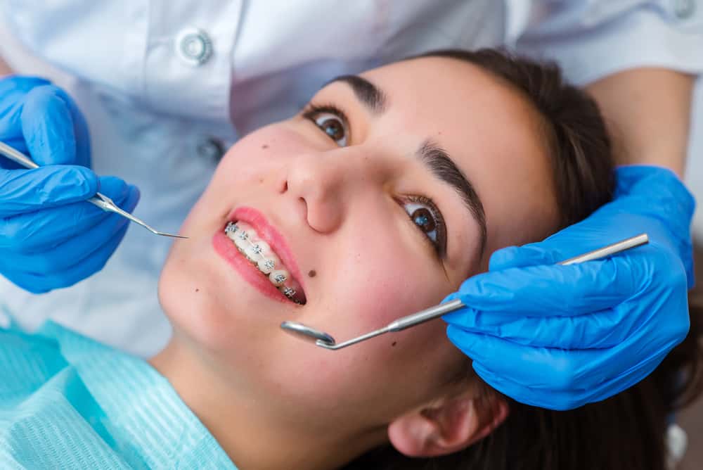 Yetişkinken diş teli (diş teli) takarsanız sonuçlar etkili olur mu?