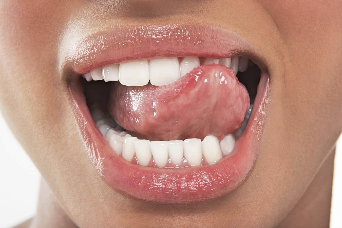 Преодолейте възпалената и пареща уста с тези 7 начина