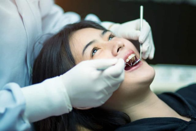 Quando è il momento giusto per l'ablazione dentale?