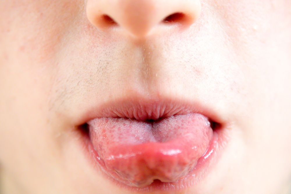 唾液が傷の治癒を早めることができるというのは本当ですか？