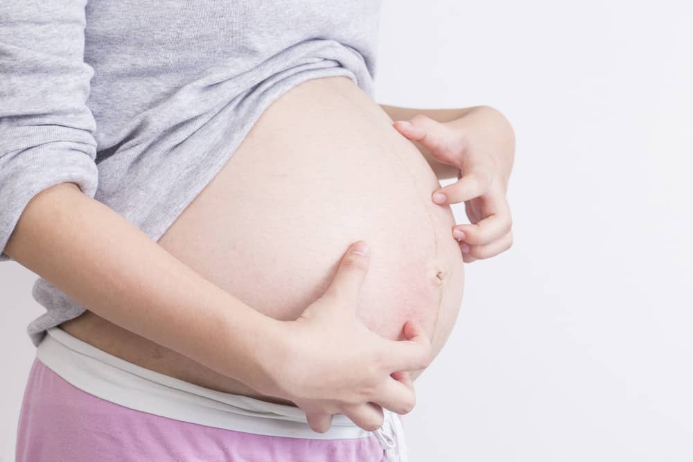 6 Cara Berkesan untuk Mengatasi Gatal Semasa Kehamilan Kerana Prurigo