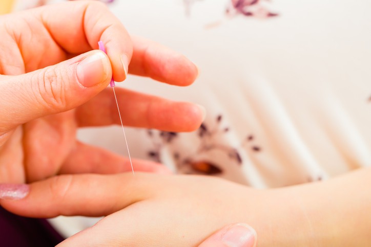 Akupunktur Semasa Kehamilan, Apa Manfaat dan Risiko?