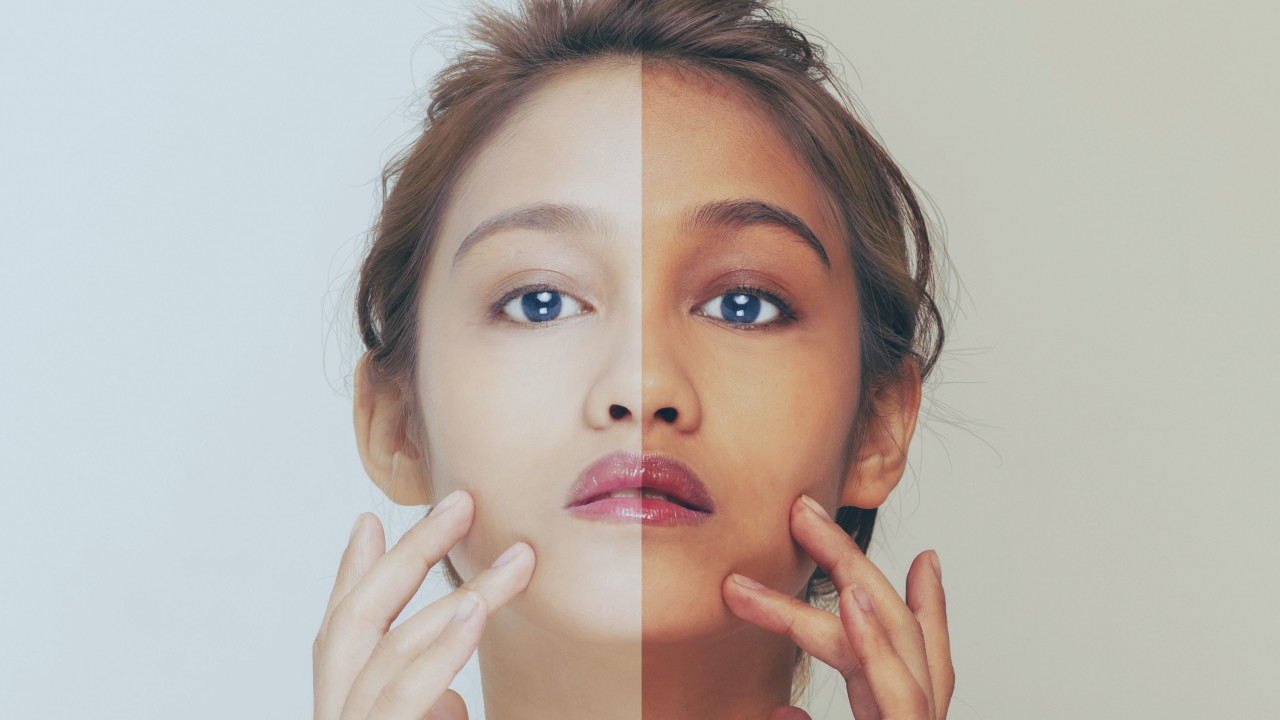 3 طرق لتبييض بشرة الوجه باستخدام علاج الطبيب