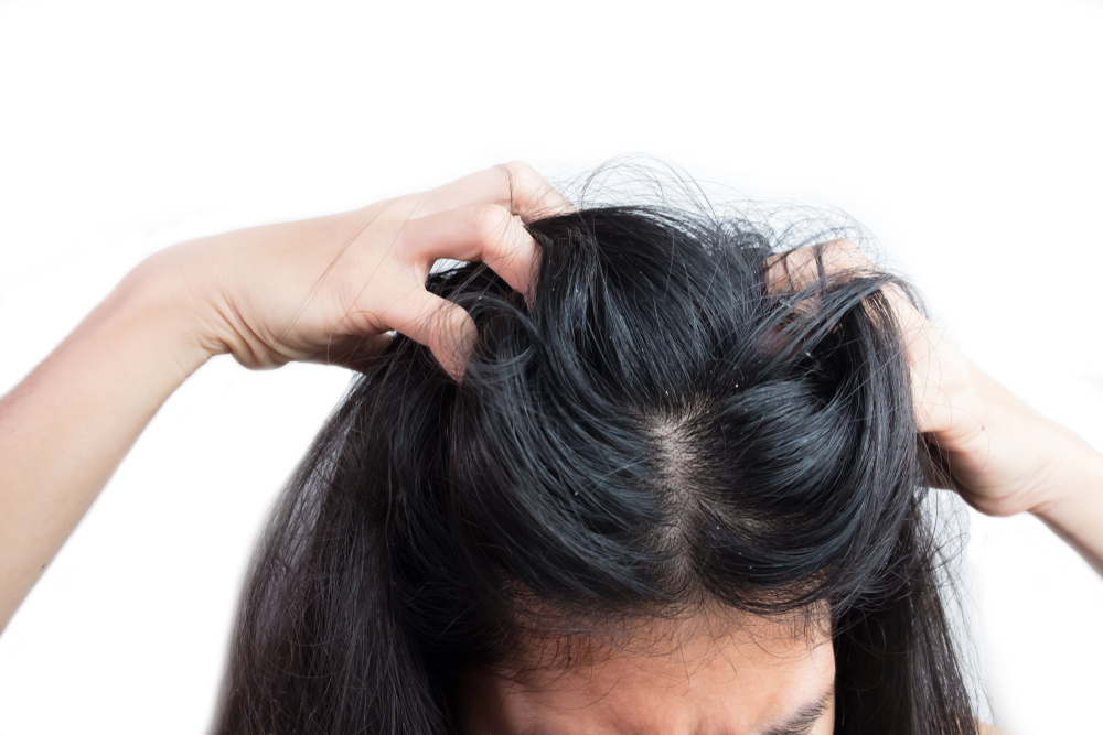 هل صحيح أن غسل الشعر بالشامبو نادرًا يجعل الشعر يصبح قشرة؟