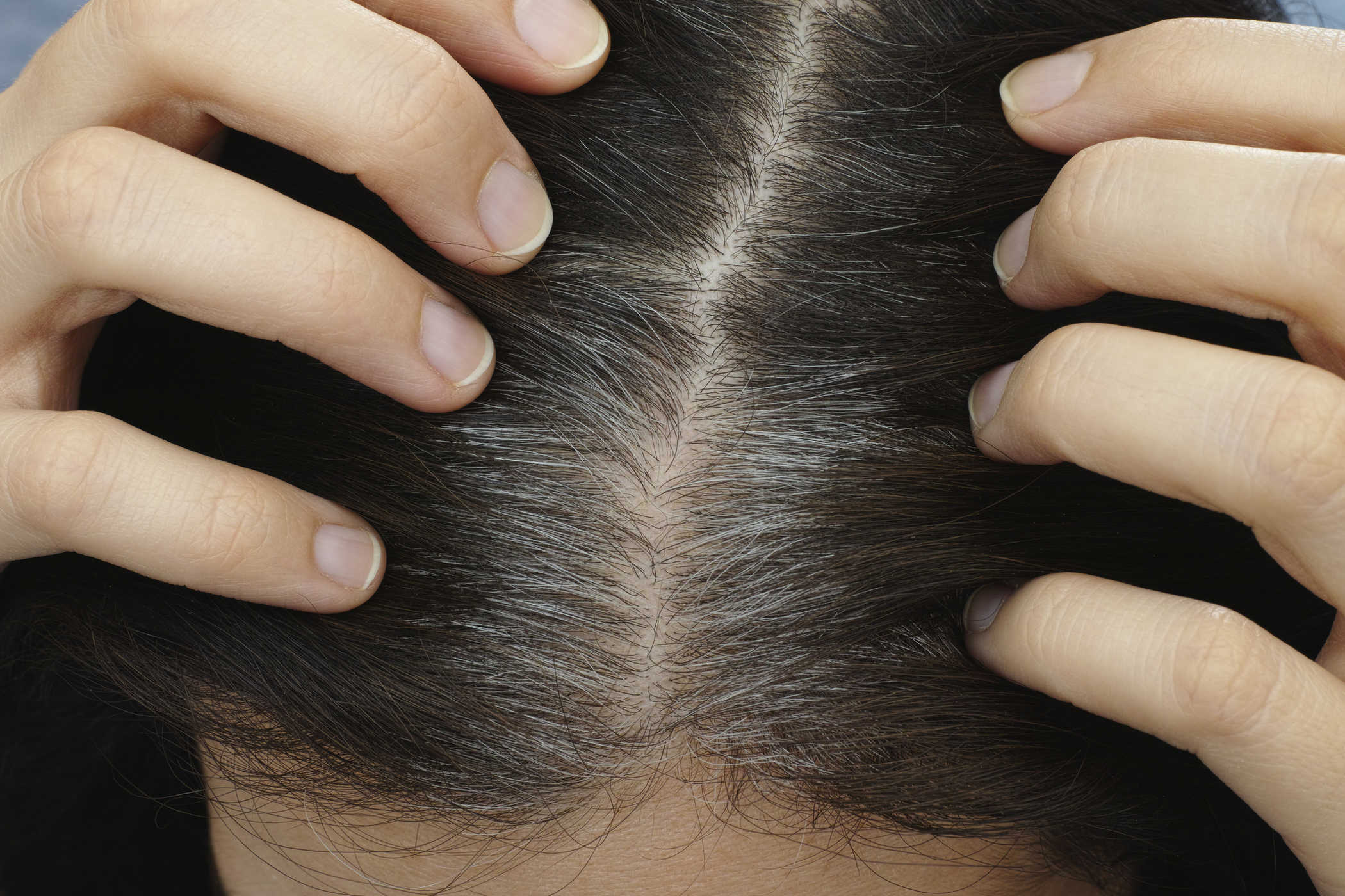 Rambut Kelabu Tidak Hanya Di Kepala: Bahagian Tubuh Mana Yang Akan Menumbuhkan Rambut Beruban?