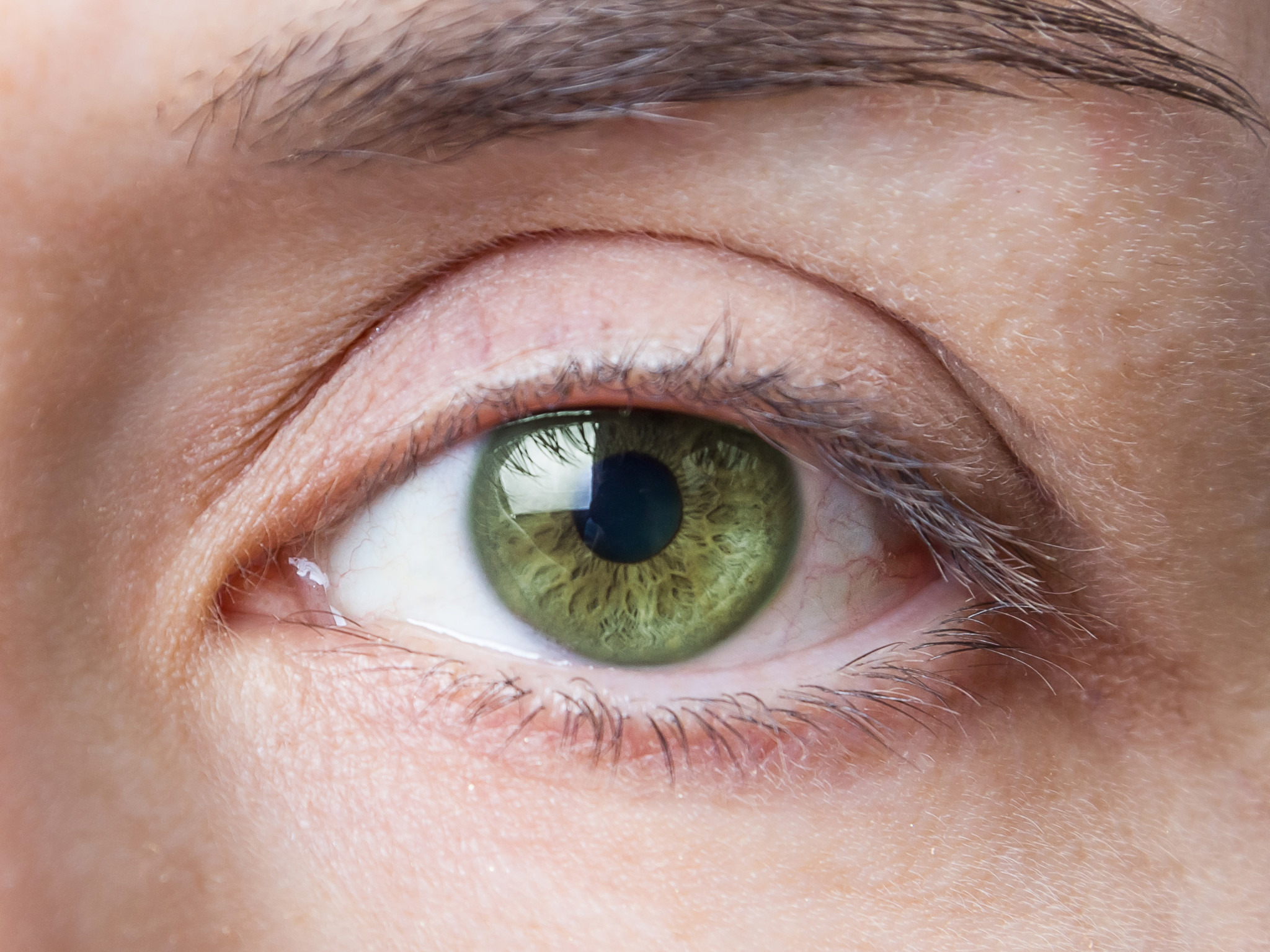 Рискът от инфекция на очите след операция на катаракта може да бъде предотвратен с антибиотици