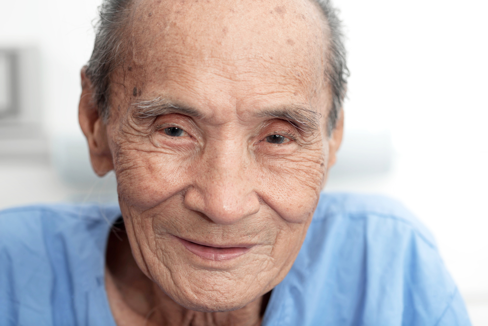 Cause e come superare l'iperlacrimazione o gli occhi acquosi negli anziani