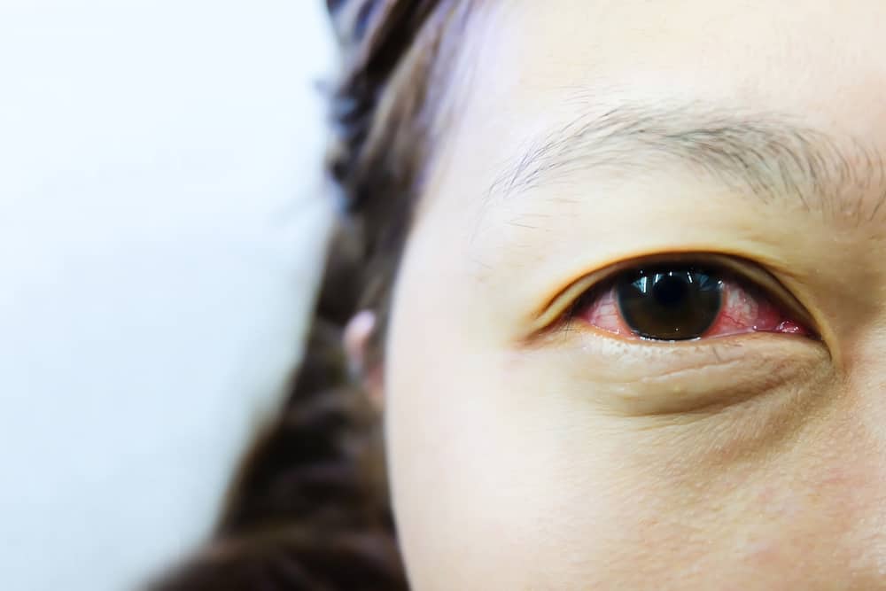 ปวดตาแดงถ่ายทอดจากการจ้องตาได้จริงหรือ? ตรวจสอบข้อเท็จจริงที่นี่!