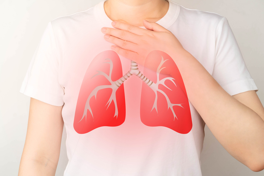 5 Komplikasi Embolisme Pulmonari yang mengancam nyawa