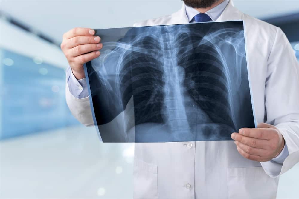 肺機能検査、息切れの原因の診断方法
