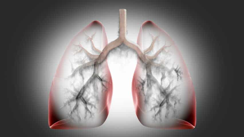 Mencegah COPD dan bagaimana mencegah keadaan menjadi lebih teruk jika anda mendapatnya