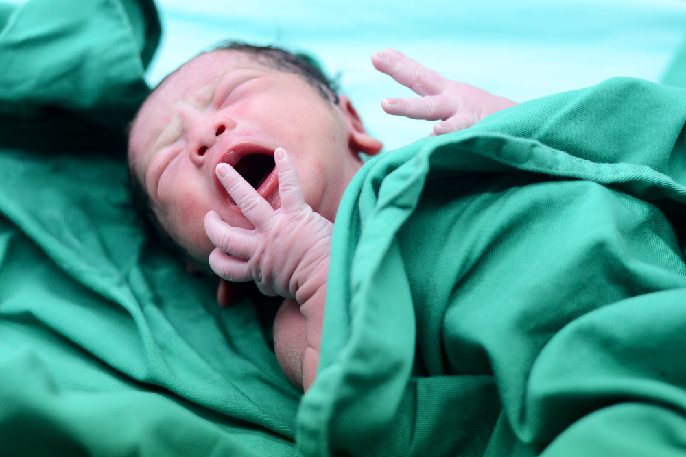 Punca Atresia Ani, Keadaan Bayi Yang Lahir Tanpa Anus