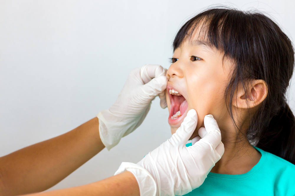 C'è sangue nella saliva dopo l'intervento alle tonsille, è normale o no, sì?
