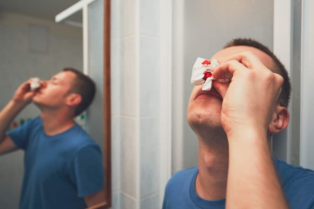Sollevare la testa può davvero fermare il sangue dal naso?