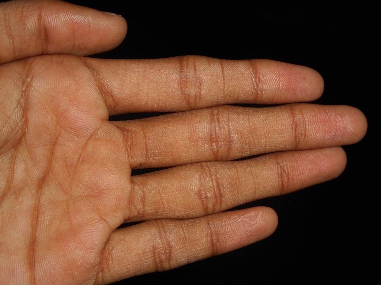Sık Sık Çalan Parmaklar Tehlikeli mi?