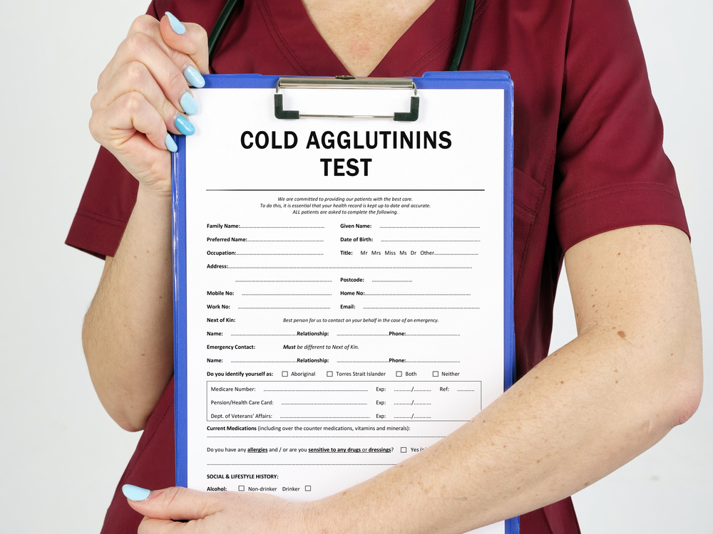 Студен аглутинин, тест за откриване на причините за болестта