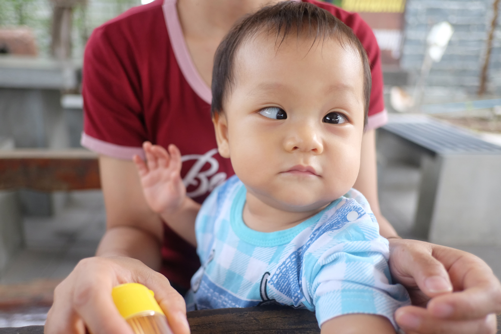 Punca Bayi Berkepit Mata dan Cara Mengatasinya untuk Kembali Ke Normal