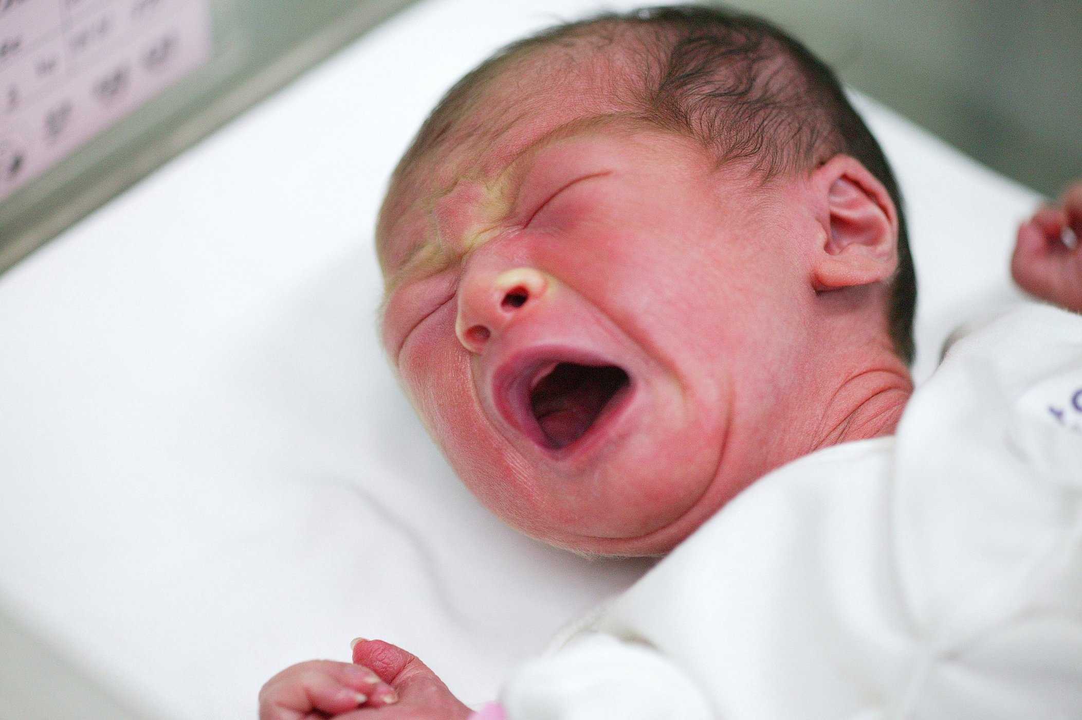 淋病感染症は赤ちゃんの目を攻撃する可能性がありますが、何が原因ですか？
