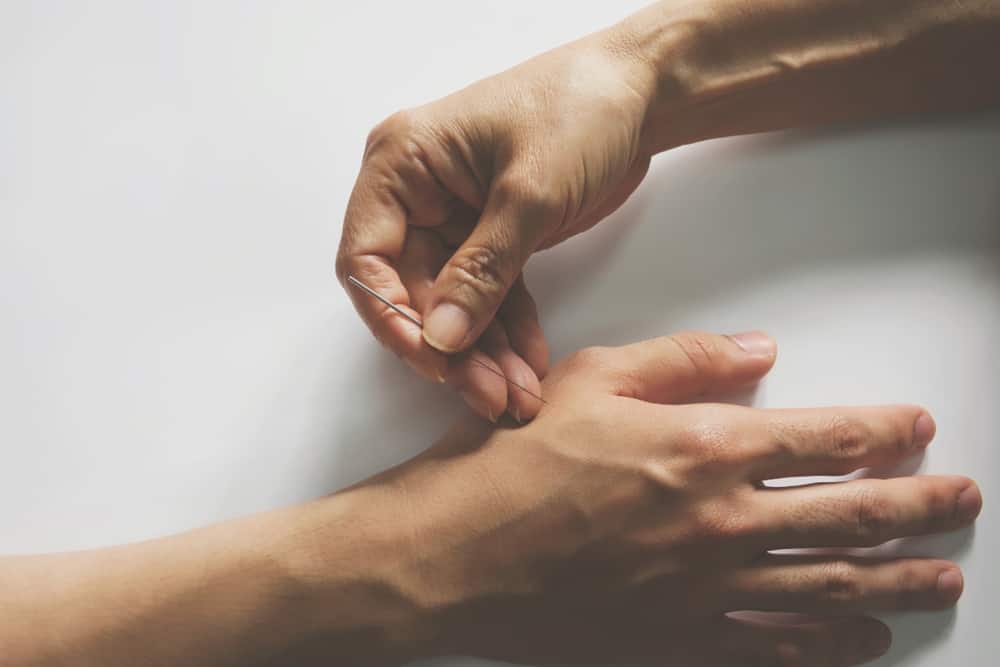 Periferik Sinir Sistemi Bozukluklarında Akupunktur Tedavisinin Faydaları