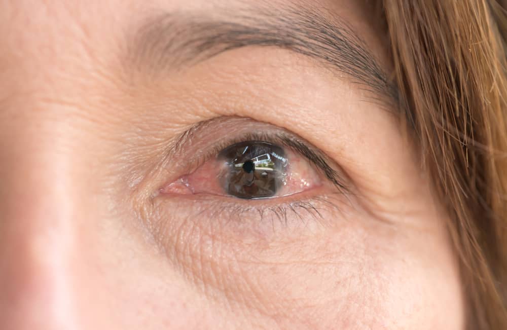 إعتام عدسة العين السكري ، عندما تسبب مضاعفات مرض السكري إعتام عدسة العين