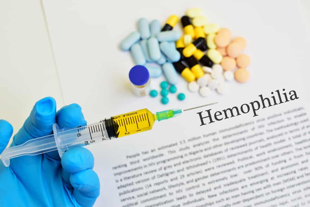 Възможности за лечение на хемофилия за лечение на симптомите